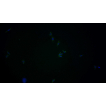 Annexin A3 (ANXA3) Human Monoclonal Antibody