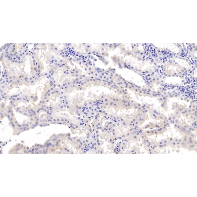 Annexin A3 (ANXA3) Human Monoclonal Antibody