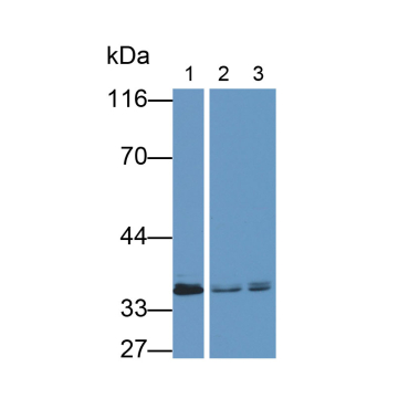 Annexin A3 (ANXA3) Human Monoclonal Antibody