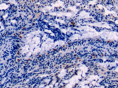 Annexin A1 (ANXA1) Rat Monoclonal Antibody