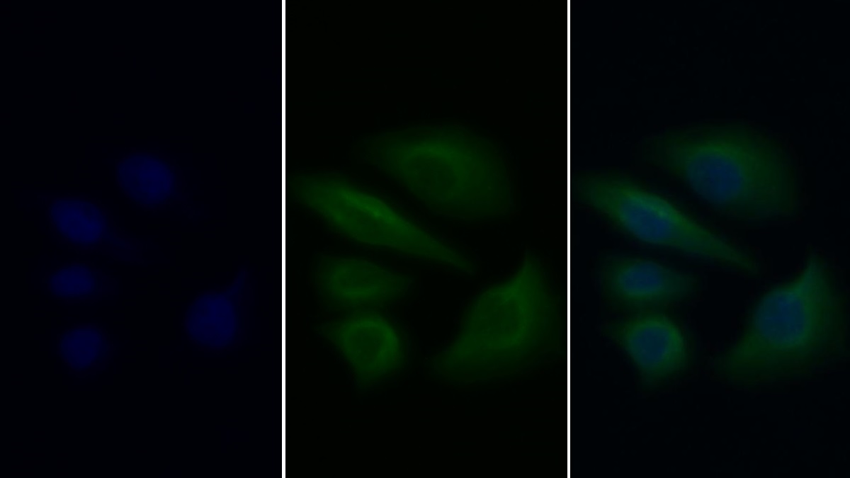 Annexin A1 (ANXA1) Rat Monoclonal Antibody