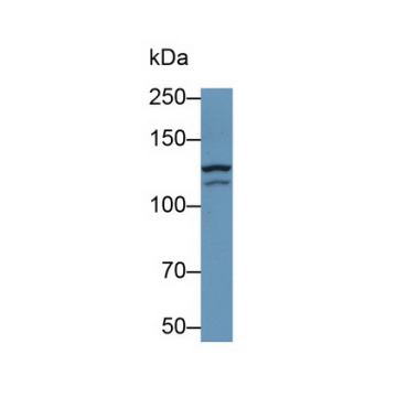 Glutamate Receptor, Ionotropic, N-Methyl-D-Aspartate 2D (GRIN2D) Human Monoclonal Antibody
