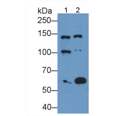Glutamate Receptor, Ionotropic, N-Methyl-D-Aspartate 2D (GRIN2D) Human Monoclonal Antibody