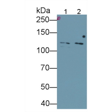 Glutamate Receptor, Ionotropic, N-Methyl-D-Aspartate 2D (GRIN2D) Human Monoclonal Antibody