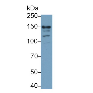 Glutamate Receptor, Ionotropic, N-Methyl-D-Aspartate 2D (GRIN2D) Human Monoclonal Antibody