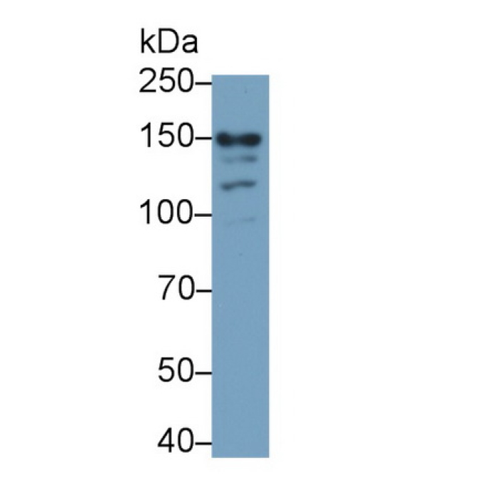 Glutamate Receptor, Ionotropic, N-Methyl-D-Aspartate 2D (GRIN2D) Human Monoclonal Antibody