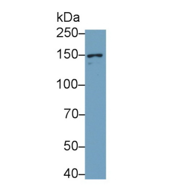 Glutamate Receptor, Ionotropic, N-Methyl-D-Aspartate 2D (GRIN2D) Human Monoclonal Antibody