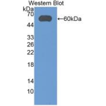 Aldehyde Dehydrogenase 7 Family, Member A1 (ALDH7A1) Human Monoclonal Antibody