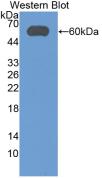 Aldehyde Dehydrogenase 7 Family, Member A1 (ALDH7A1) Human Monoclonal Antibody