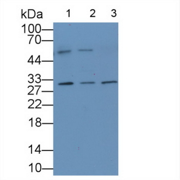 Interleukin 1 Epsilon (IL1e) Human Monoclonal Antibody