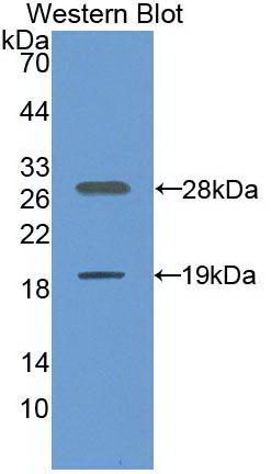 Sirtuin 1 (SIRT1) Human Monoclonal Antibody
