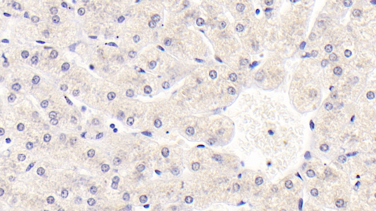 Sirtuin 3 (SIRT3) Human Monoclonal Antibody