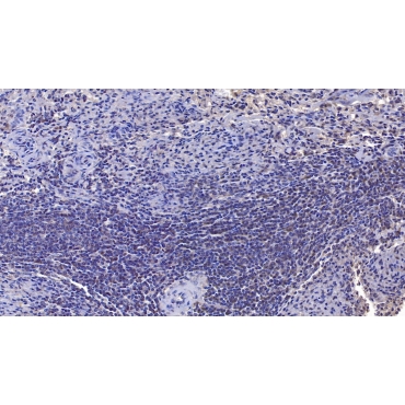 Sirtuin 3 (SIRT3) Human Monoclonal Antibody