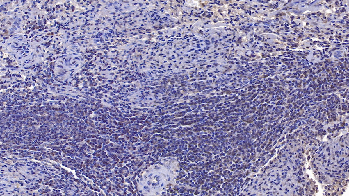 Sirtuin 3 (SIRT3) Human Monoclonal Antibody