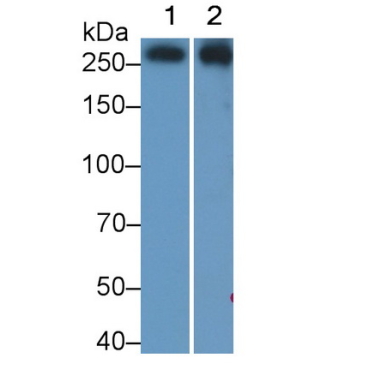 Filamin C Gamma (FLNC) Human Monoclonal Antibody