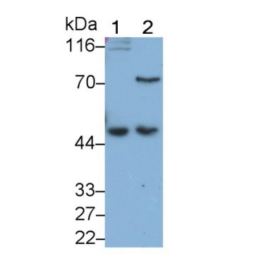 Wilms Tumor Protein (WT1) Human Monoclonal Antibody