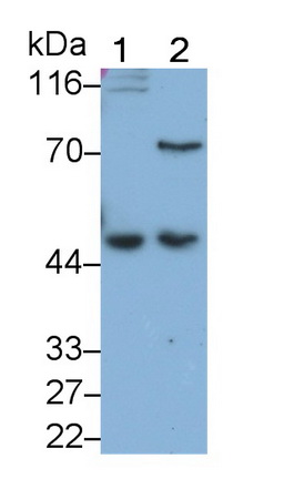 Wilms Tumor Protein (WT1) Human Monoclonal Antibody