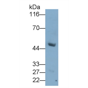 Anthrax Toxin Receptor 2 (ANTXR2) Human Monoclonal Antibody
