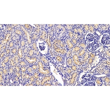 Anthrax Toxin Receptor 2 (ANTXR2) Human Monoclonal Antibody