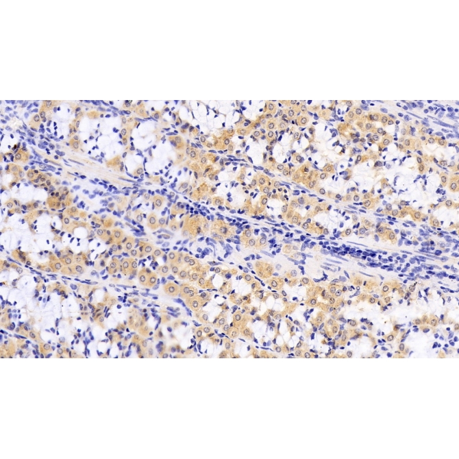Anthrax Toxin Receptor 2 (ANTXR2) Human Monoclonal Antibody