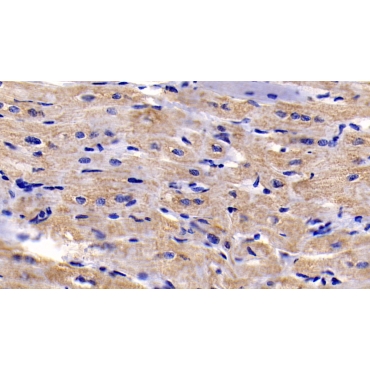 Brain Specific Angiogenesis Inhibitor 3 (BAI3) Human Monoclonal Antibody