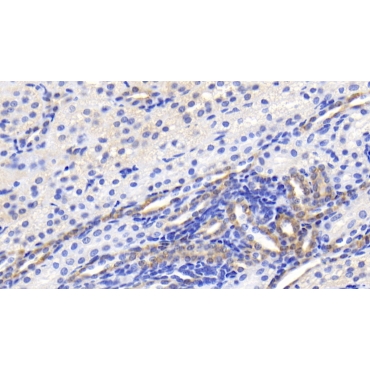 Brain Specific Angiogenesis Inhibitor 3 (BAI3) Human Monoclonal Antibody
