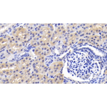 Brain Specific Angiogenesis Inhibitor 3 (BAI3) Human Monoclonal Antibody