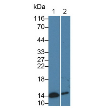 Cellular Retinoic Acid Binding Protein 2 (CRABP2) Human Monoclonal Antibody