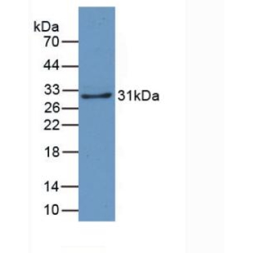 Crystallin Lambda 1 (CRYl1) Human Monoclonal Antibody