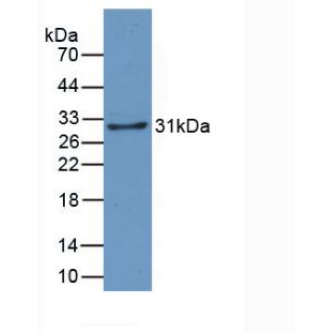 Crystallin Lambda 1 (CRYl1) Human Monoclonal Antibody