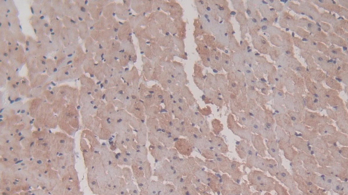 Heat Shock Protein Beta 6 (HSPb6) Rat Monoclonal Antibody