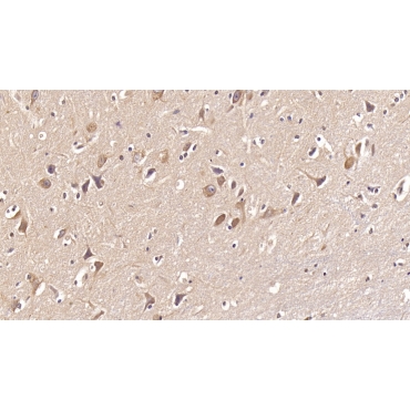 Doublecortin Like Kinase 1 (DCLK1) Human Monoclonal Antibody