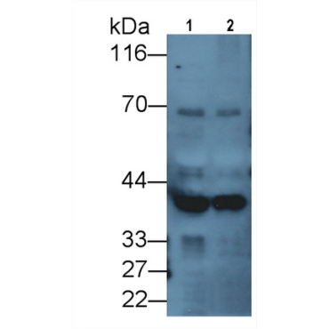Doublecortin Like Kinase 1 (DCLK1) Human Monoclonal Antibody