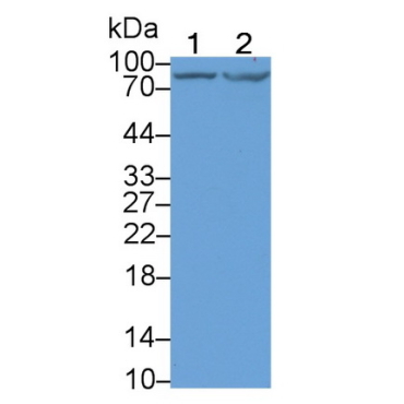 Doublecortin Like Kinase 1 (DCLK1) Human Monoclonal Antibody