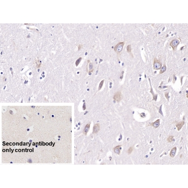 Doublecortin Like Kinase 1 (DCLK1) Human Monoclonal Antibody
