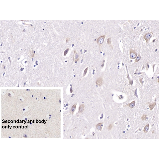 Doublecortin Like Kinase 1 (DCLK1) Human Monoclonal Antibody