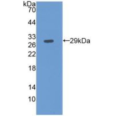 Fibulin 3 (FBLN3) Human Monoclonal Antibody