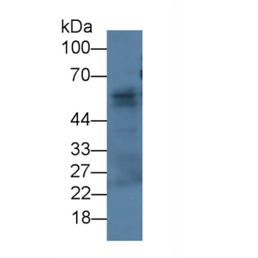 Fibulin 3 (FBLN3) Human Monoclonal Antibody