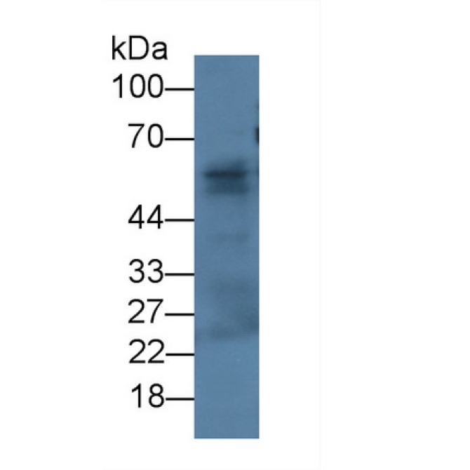 Fibulin 3 (FBLN3) Human Monoclonal Antibody