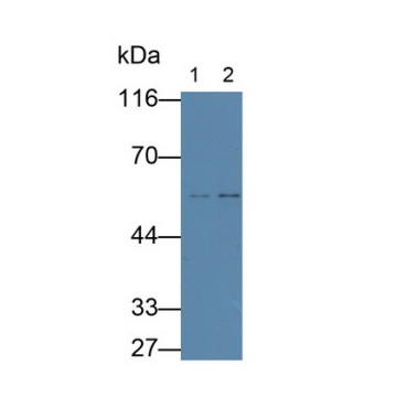 Fibulin 3 (FBLN3) Human Monoclonal Antibody