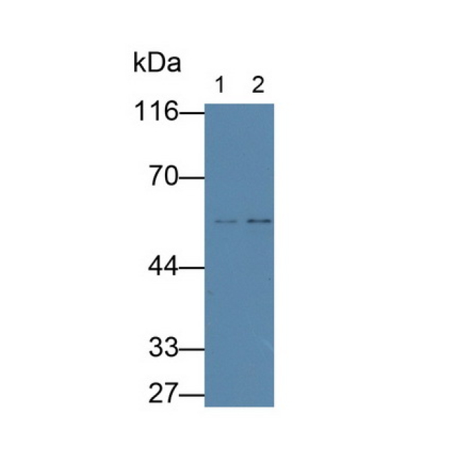 Fibulin 3 (FBLN3) Human Monoclonal Antibody