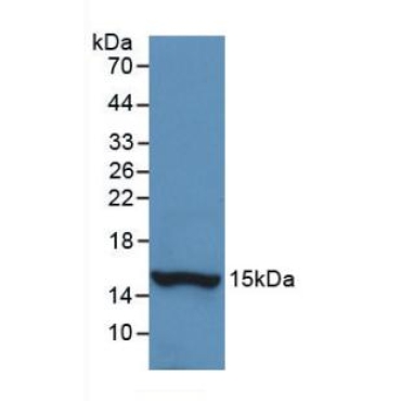 Histatin 1 (HTN1) Human Monoclonal Antibody