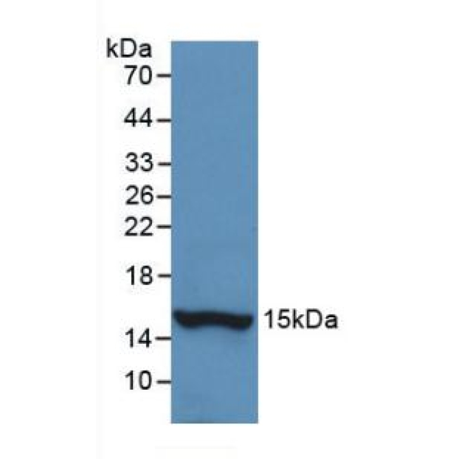 Histatin 1 (HTN1) Human Monoclonal Antibody