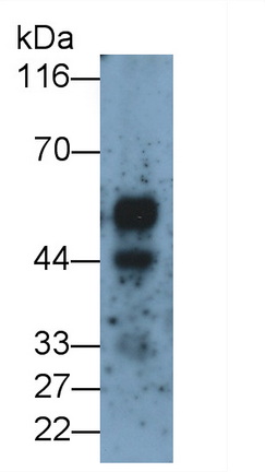 Kisspeptin Receptor (KISS1R) Rat Monoclonal Antibody