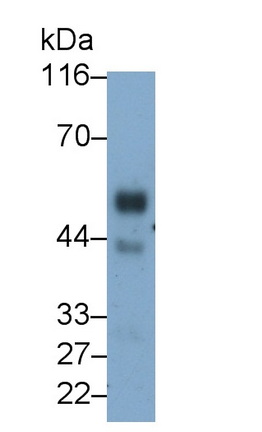 Kisspeptin Receptor (KISS1R) Rat Monoclonal Antibody