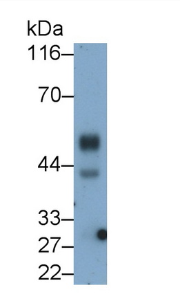 Kisspeptin Receptor (KISS1R) Rat Monoclonal Antibody