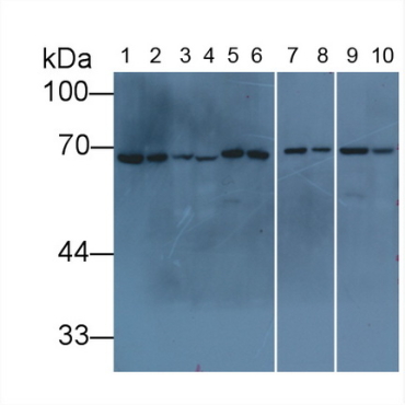Lamin B1 (LMNB1) Human Monoclonal Antibody