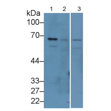 Lamin B1 (LMNB1) Human Monoclonal Antibody