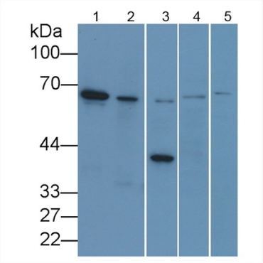 Lamin B1 (LMNB1) Human Monoclonal Antibody