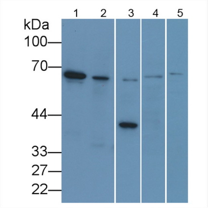 Lamin B1 (LMNB1) Human Monoclonal Antibody
